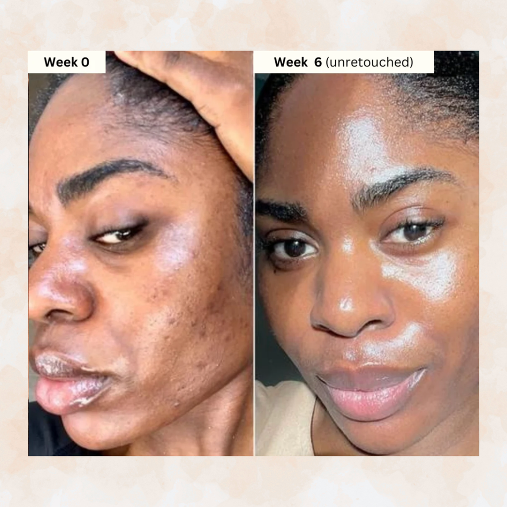 Turmeric & Kojic Acid - Skin Brightening Soap