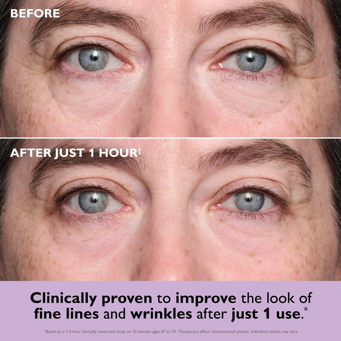 Viralluxe Instant FirmX Collagen Eye Patches