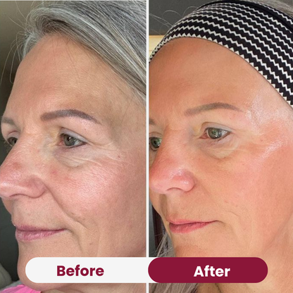 Bio-Collagen Mask 2.0