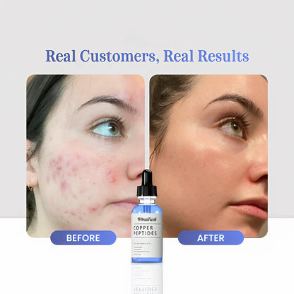 GHK-Cu Copper Peptides Serum