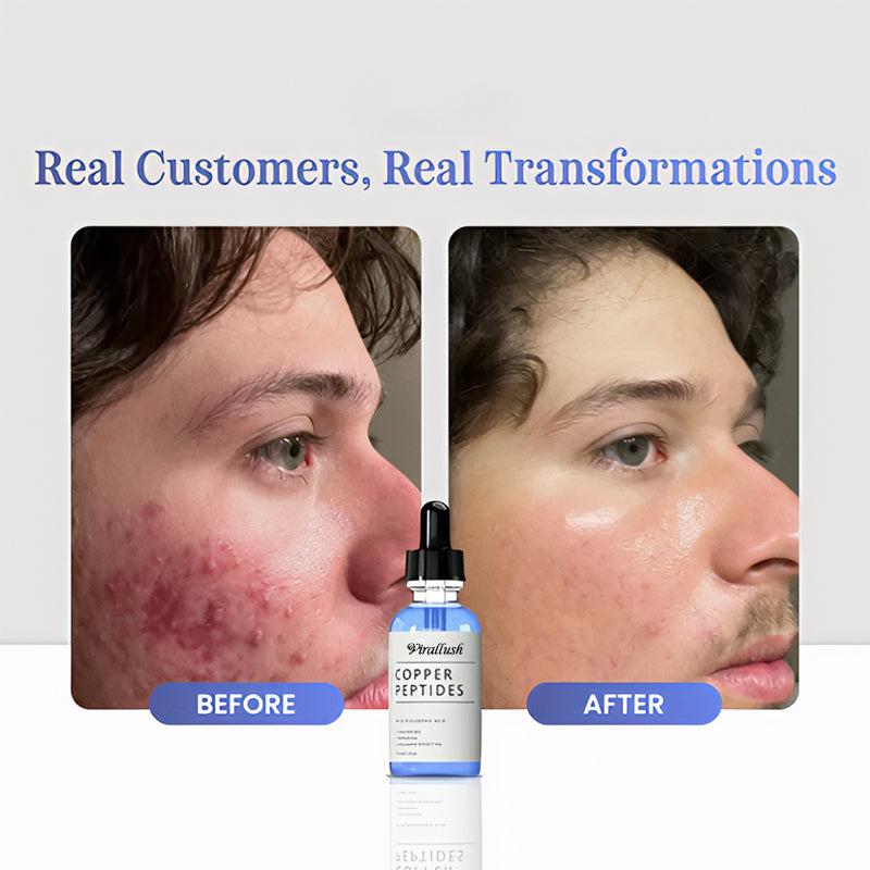 GHK-Cu Copper Peptides Serum