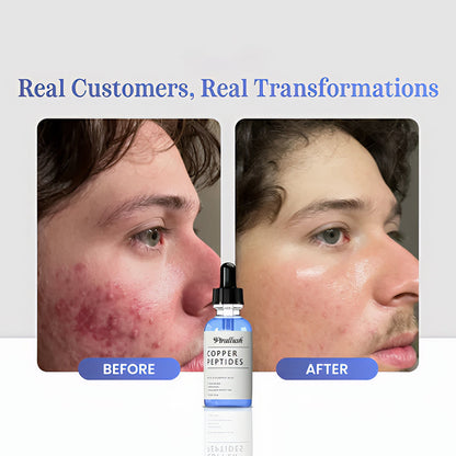 GHK-Cu Copper Peptides Serum