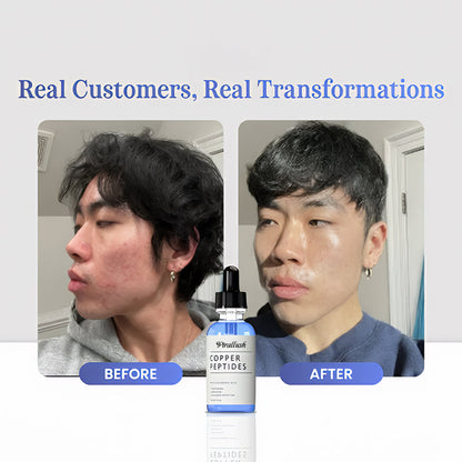 GHK-Cu Copper Peptides Serum