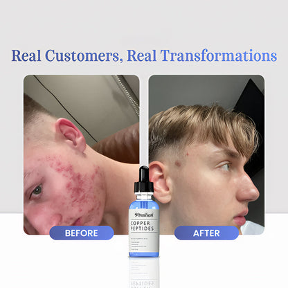 GHK-Cu Copper Peptides Serum