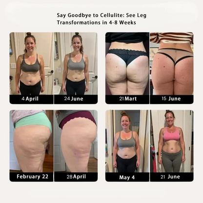 Women's Anti-Cellulite Massaging 3D Leggings