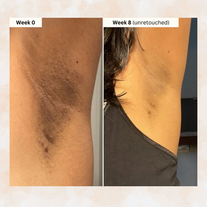 Turmeric & Kojic Acid - Skin Brightening Soap