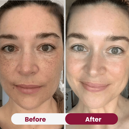 Bio-Collagen Mask 2.0