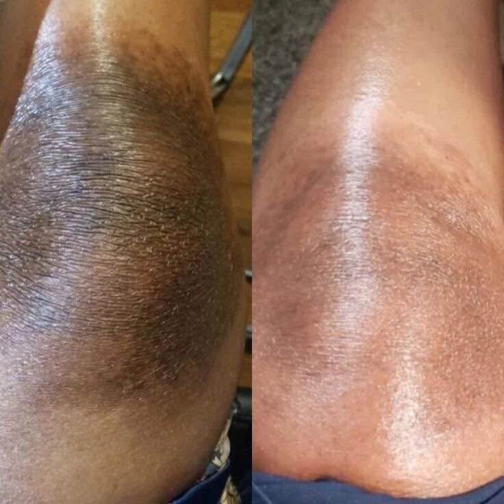 Turmeric & Kojic Acid Body Cream