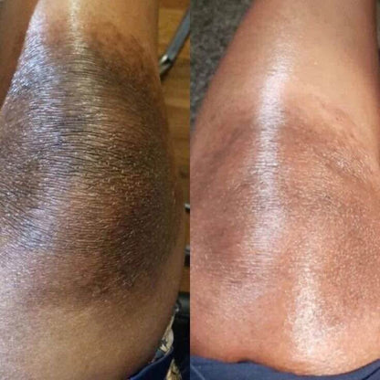 Turmeric & Kojic Acid Body Cream