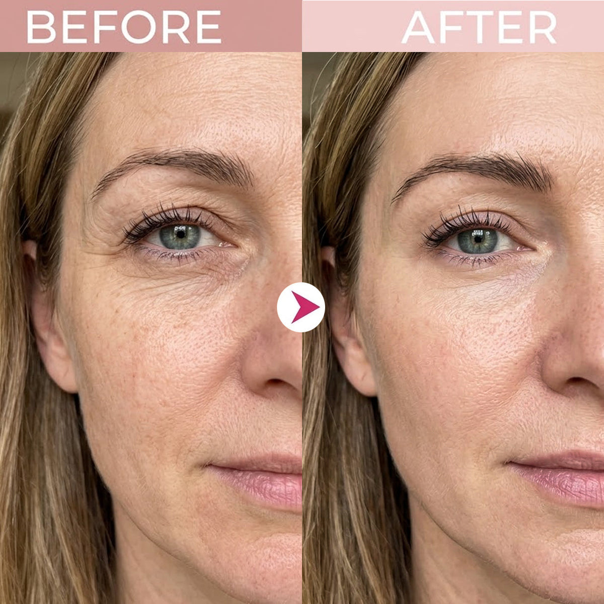 P7 Eye Renewal Crème✨