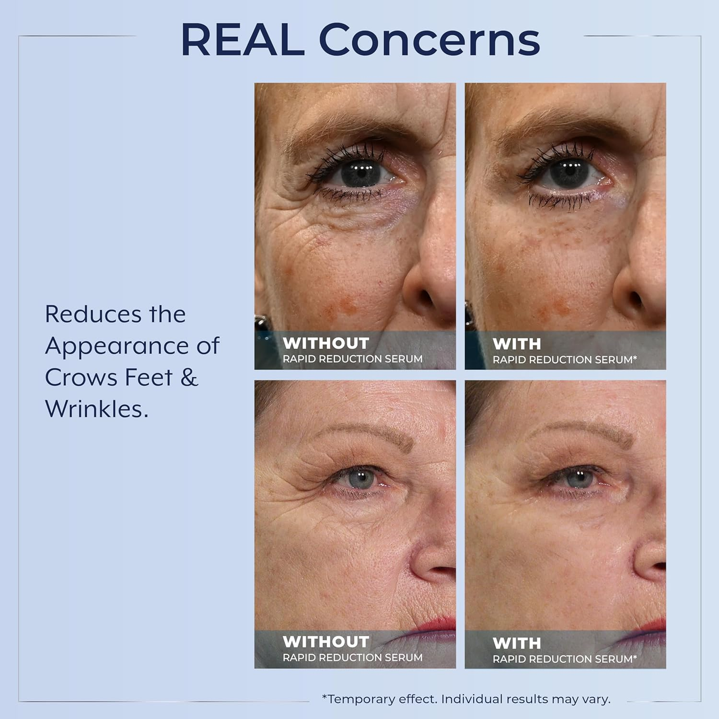 Rapid Reduction Wrinkle Serum