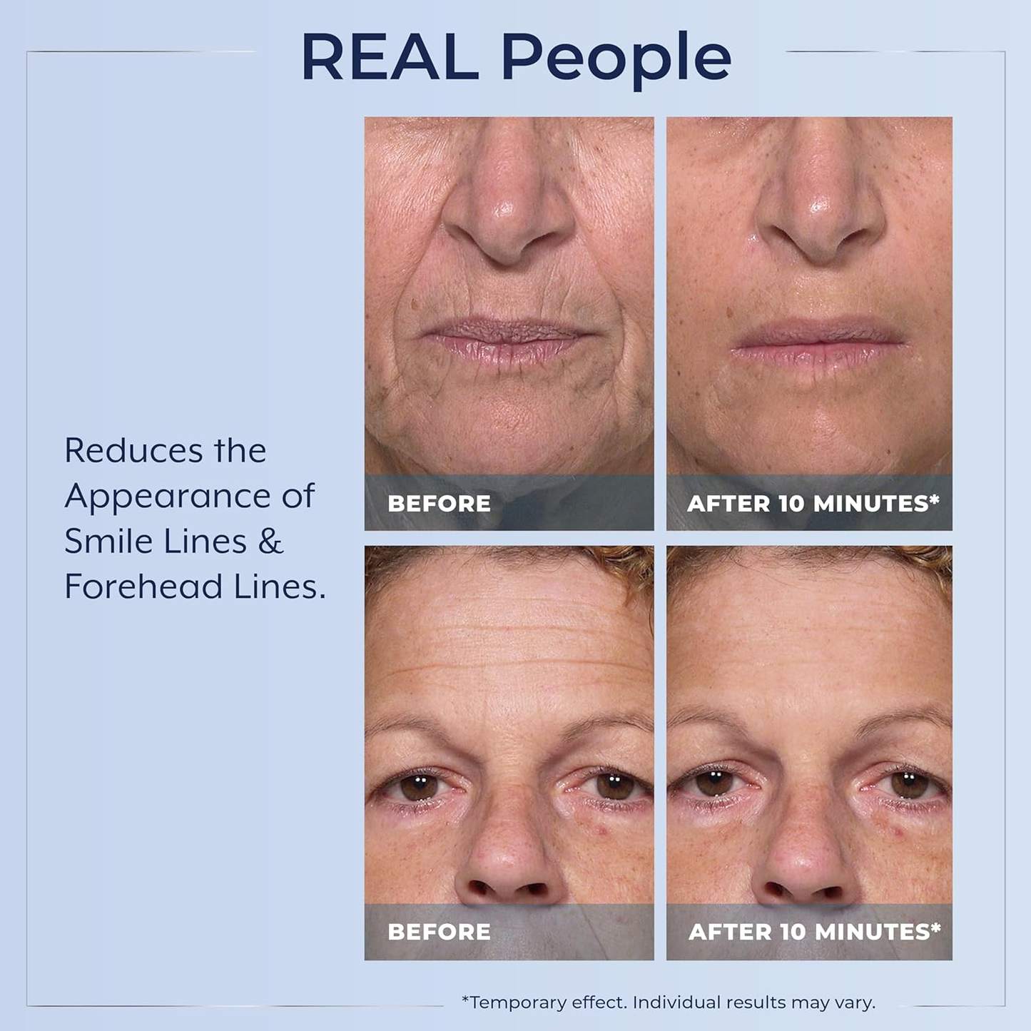 Rapid Reduction Wrinkle Serum