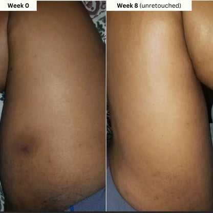 Turmeric & Kojic Acid Body Cream