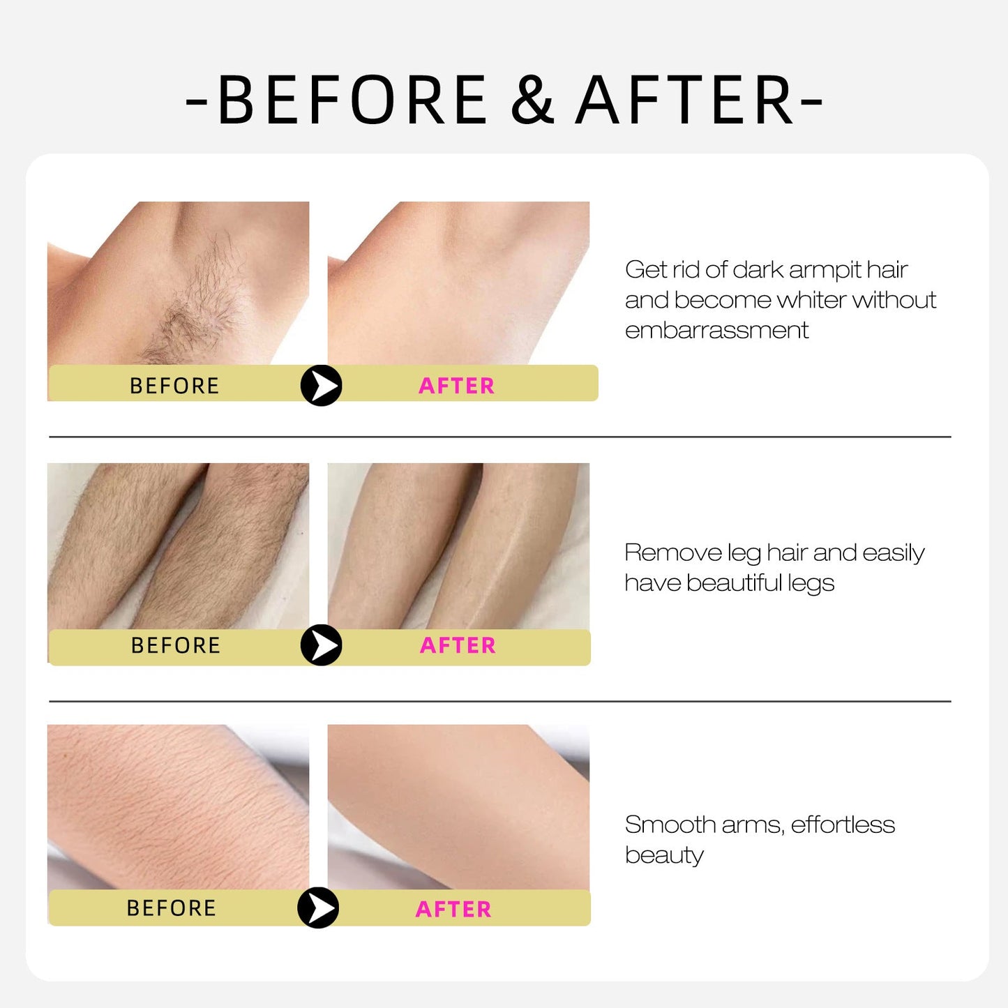 Cyperus Rotundus Oil for Natural Permanent Hair Reduction