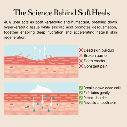 Dermatologist Recommended: Intensive Foot cream