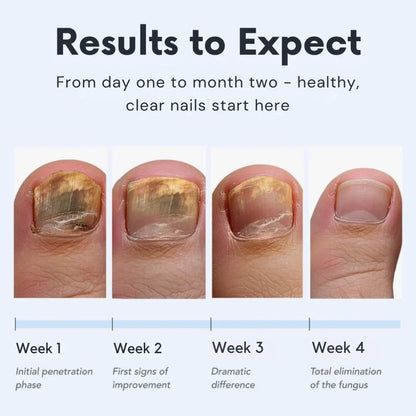 Lumiieren™ Antifungal Pen