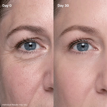 P7 Eye Renewal Crème✨